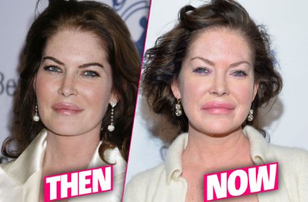 A before and after plastic surgery picture of Lara Flynn Boyle.